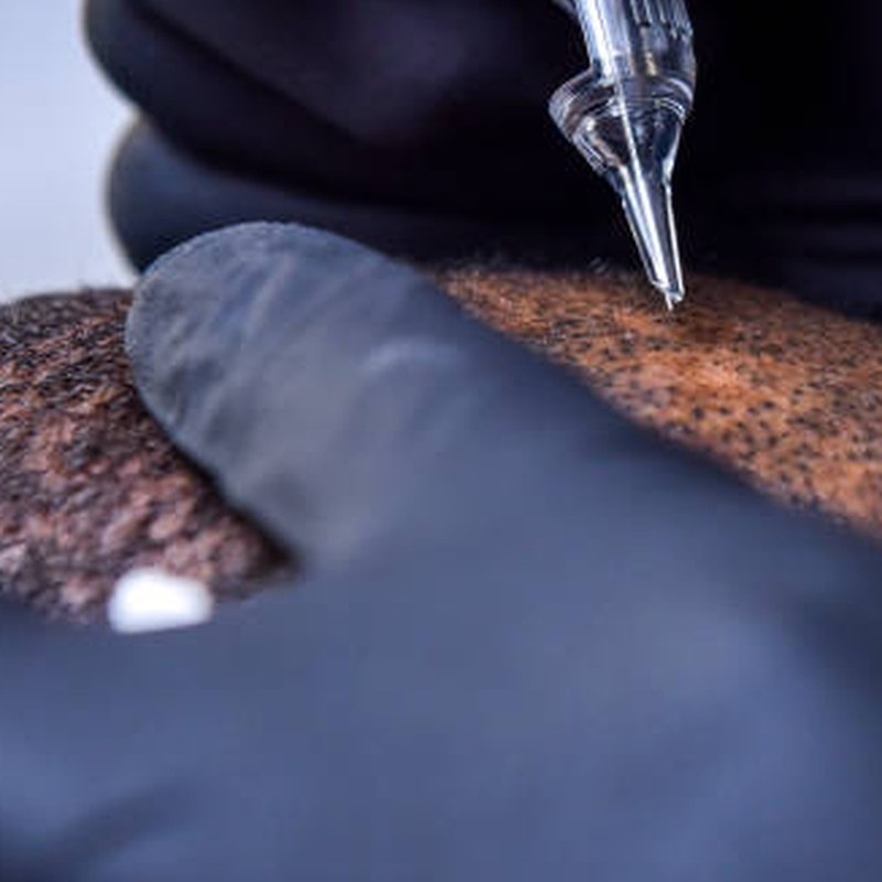 In-home mobile scalp micropigmentation setup and treatment station